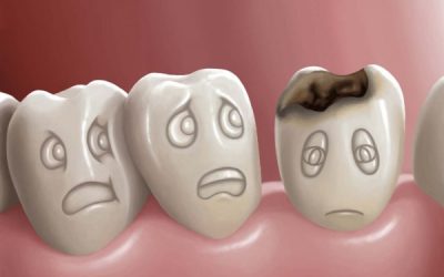 Próchnica zębów – pomocna rola diety