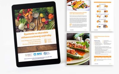 Narodowe Centrum Edukacji Żywieniowej|Migrena a dieta i inne czynniki stylu życia